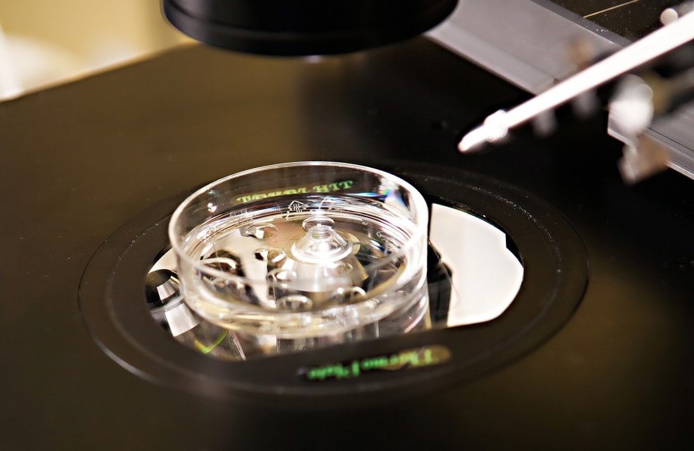 Trứng thụ tinh với tinh trùng trong một đĩa petri tạo thành phôi