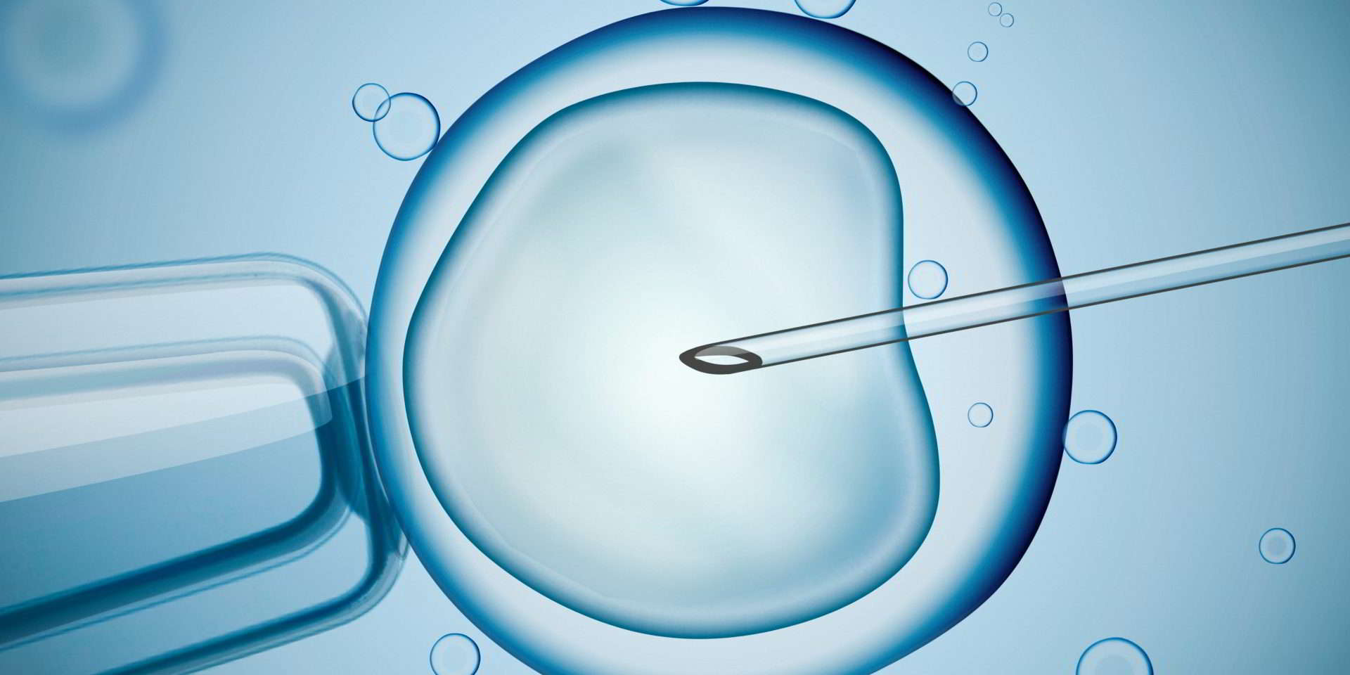 Tiêm tinh trùng vào bào tương trứng - ICSI (Intracytoplasmic Sperm Injection)